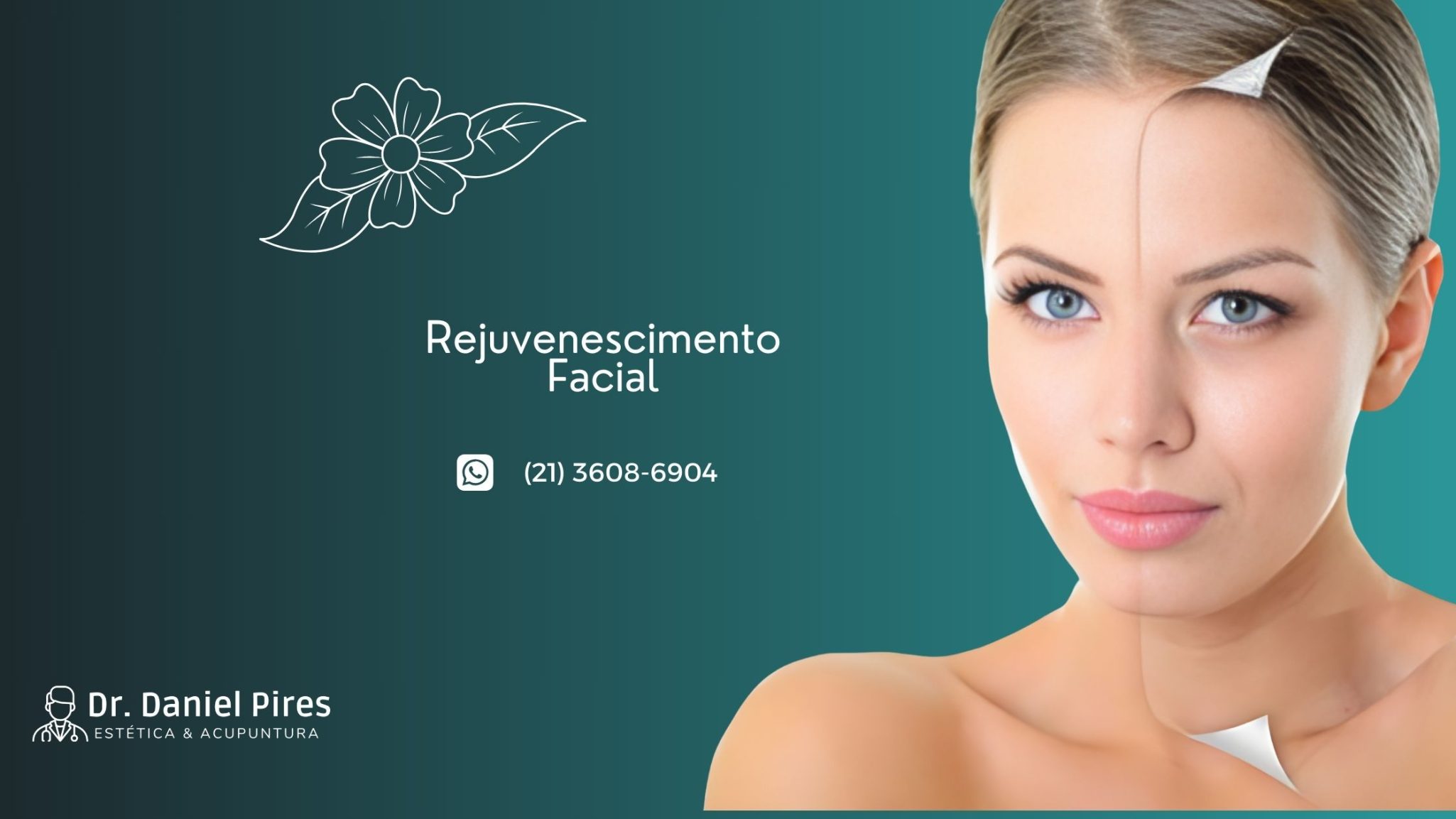 Read more about the article Rejuvenscimento facial e seus benefícios